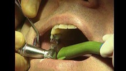 Die Rechentricks des Dr. Schirbort - Zahnärzteboß zockt bei Patienten ab  